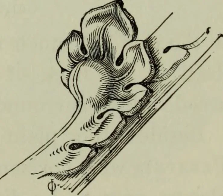 An illustration from The principles of Gothic ecclesiastical architecture : with an explanation of technical terms and a centenary of ancient terms ..., 1882, leaf 246