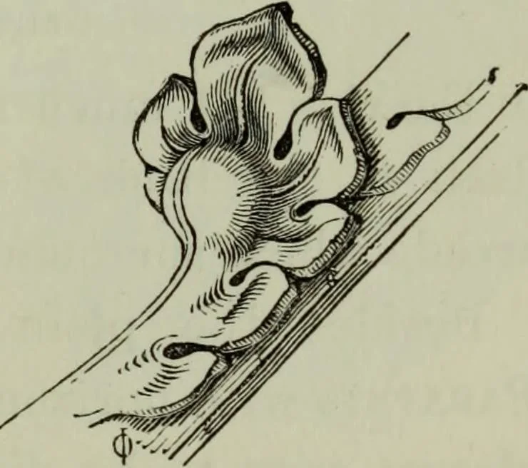 An illustration from The principles of Gothic ecclesiastical architecture : with an explanation of technical terms and a centenary of ancient terms ..., 1882, leaf 246