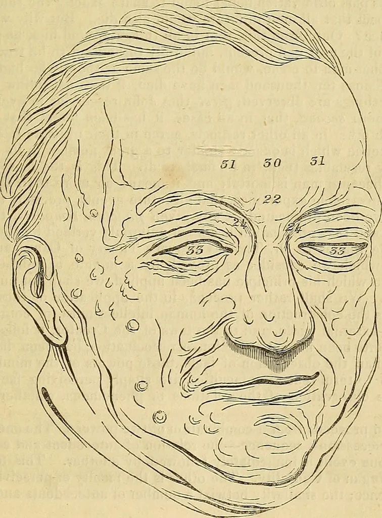 An illustration from The principles of phrenology, 1838, leaf 226