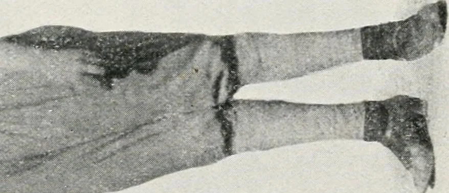 An illustration from Protective clothing for women and girl workers employed in the factories and workshops, 1917, leaf 12