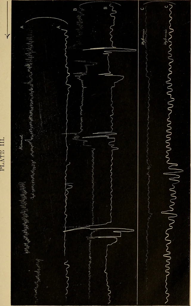 An illustration from The psychology of suggestion; a research into the subconscious nature of man and society, 1898, leaf 134