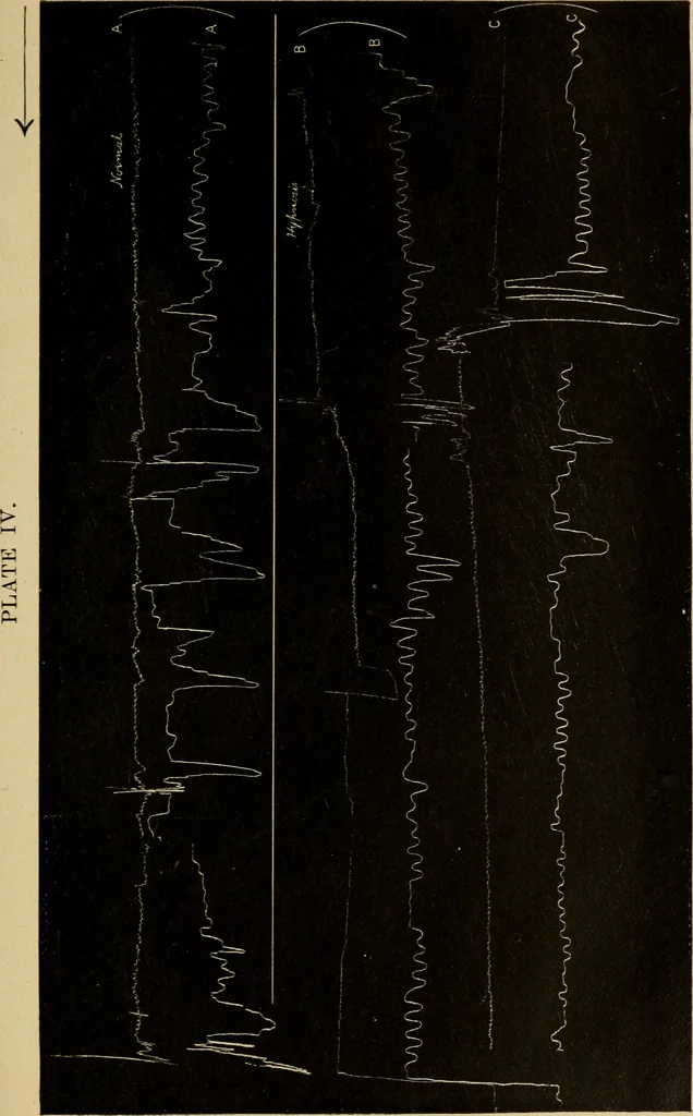 An illustration from The psychology of suggestion; a research into the subconscious nature of man and society, 1898, leaf 138