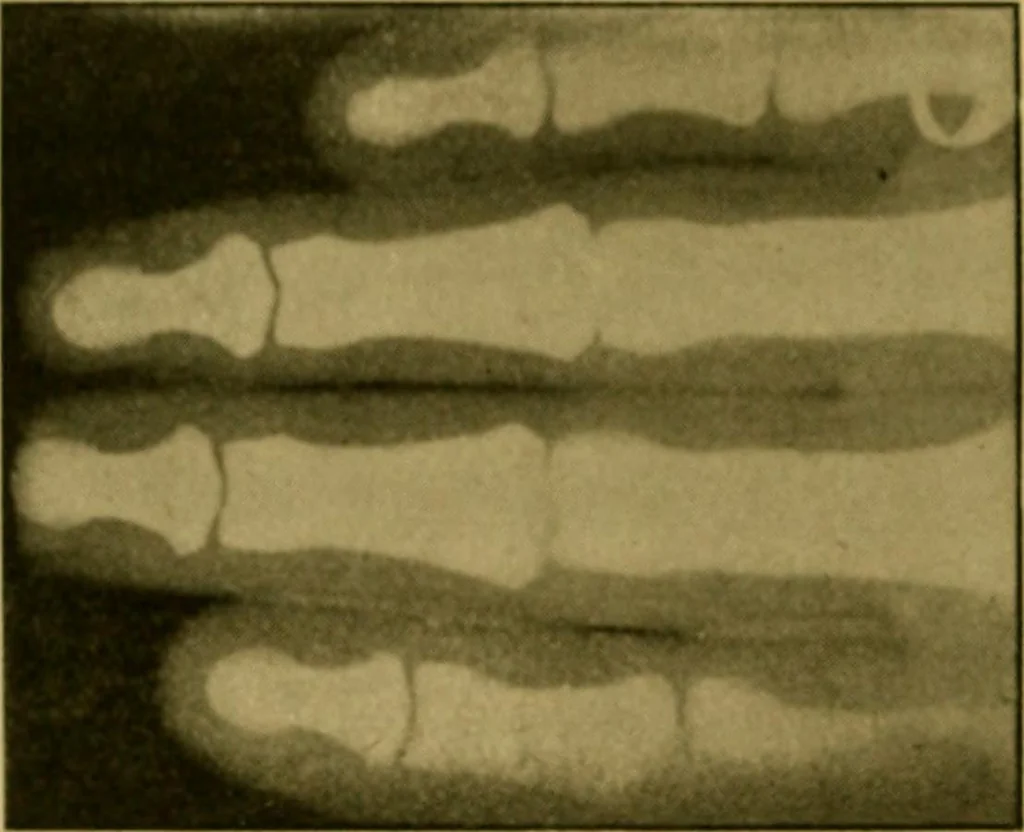 An illustration from Radiography and the 'X' rays in practice and theory : with constructional manipulatory details, 1898, leaf 163