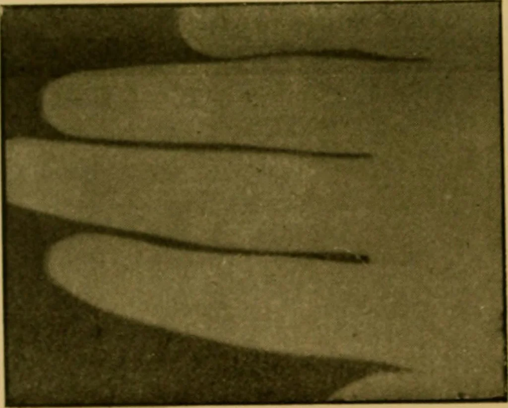 An illustration from Radiography and the 'X' rays in practice and theory : with constructional manipulatory details, 1898, leaf 163