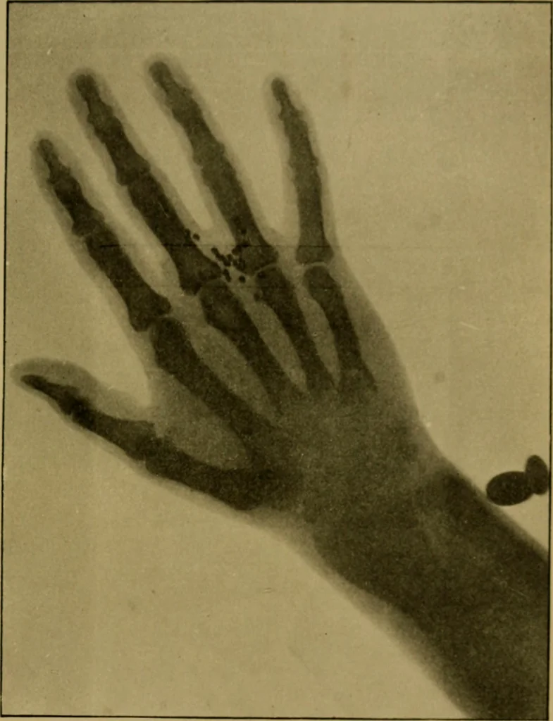 An illustration from Radiography and the 'X' rays in practice and theory : with constructional manipulatory details, 1898, leaf 192
