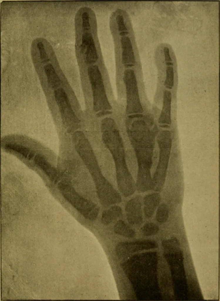 An illustration from Radiography and the 'X' rays in practice and theory : with constructional manipulatory details, 1898, leaf 194