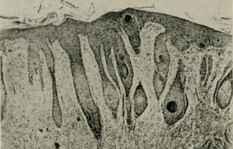 An illustration from Radium, X rays and the living cell, 1915, leaf 183