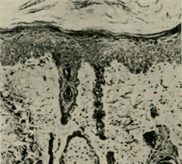 An illustration from Radium, X rays and the living cell, 1915, leaf 183