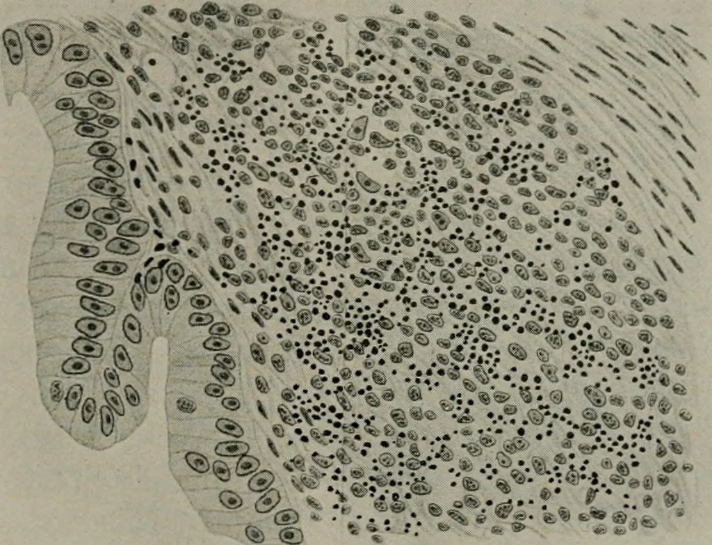 An illustration from Radium, X rays and the living cell, 1915, leaf 220