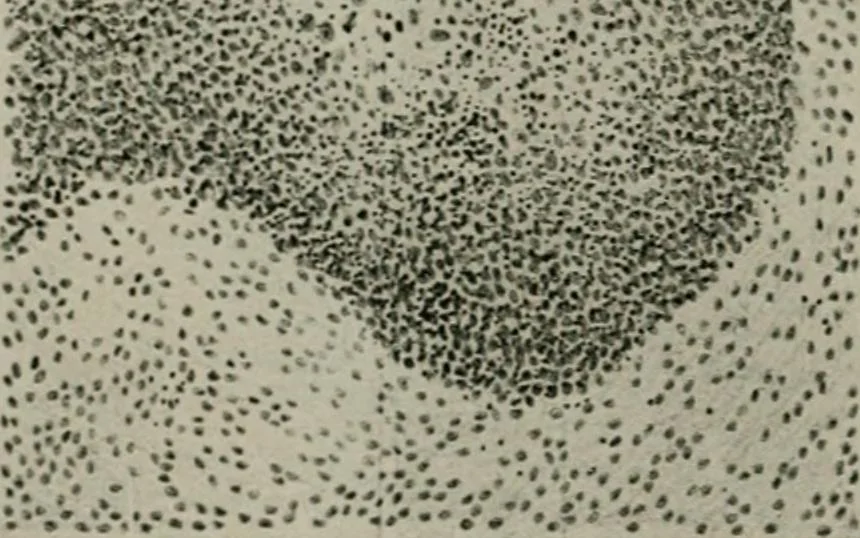 An illustration from Radium, X rays and the living cell, 1915, leaf 221