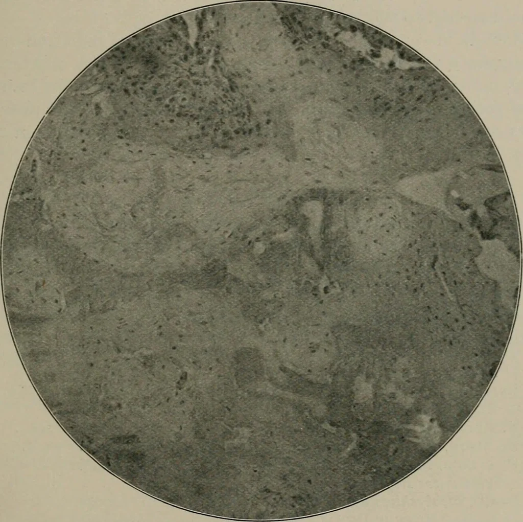 An illustration from Radium, X rays and the living cell, 1915, leaf 288