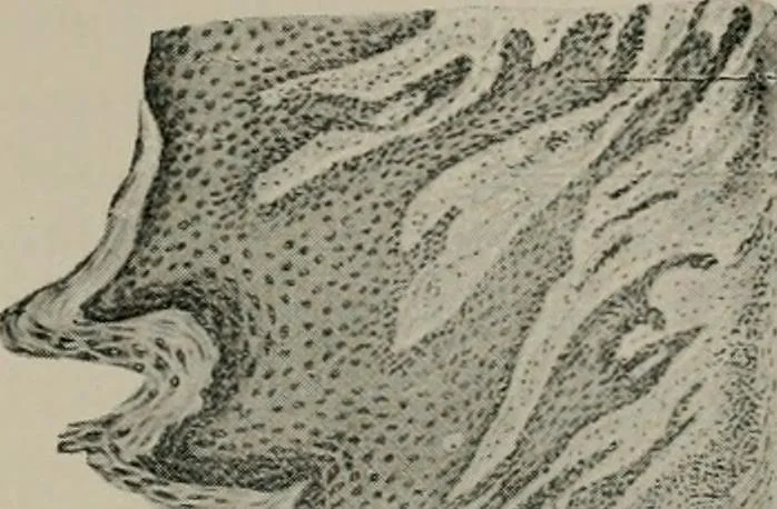 An illustration from Radium, X rays and the living cell, 1915, leaf 304