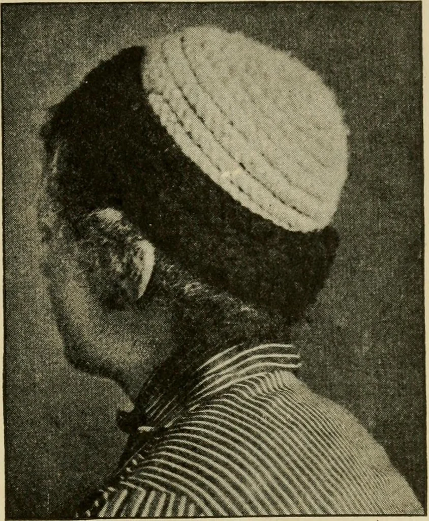 An illustration from Rake knitting and its special adaptation to invalid workers, 1916, leaf 24