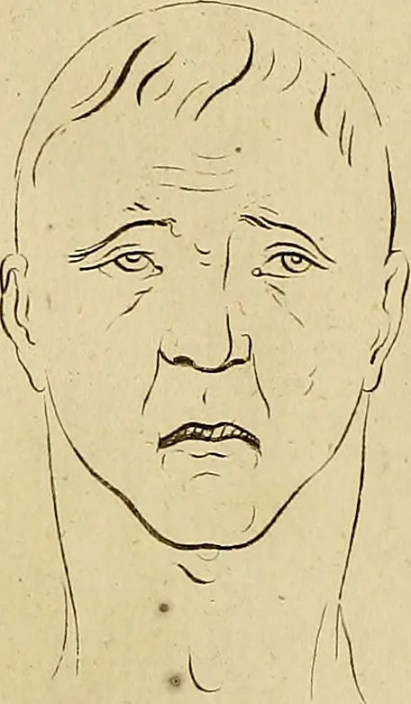 An illustration from Redenvoeringen van wylen Petrus Camper, over de wyze, om de onderscheidene hartstogten op onze wezens te verbeelden : over de verbaazende overeenkomst tusschen de viervoetige dieren, de vogelen, de visschen en den mensch, en over het gedaante schoon : gehouden in de Teken Academie te Amsterdam, 1792, leaf 118