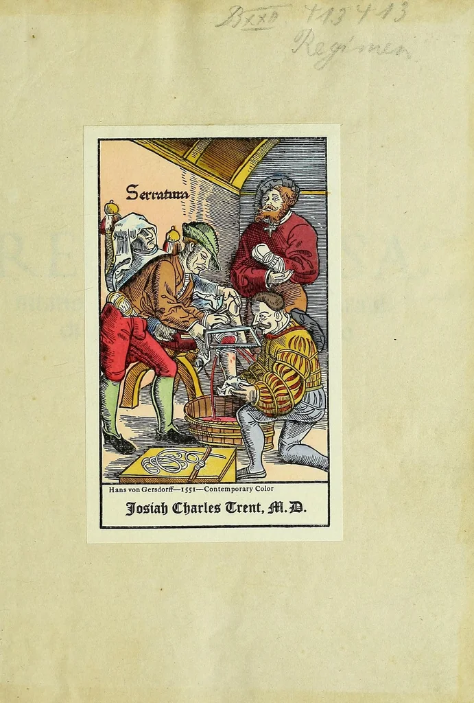 An illustration from Regimen sanitatis, 1500, leaf 3