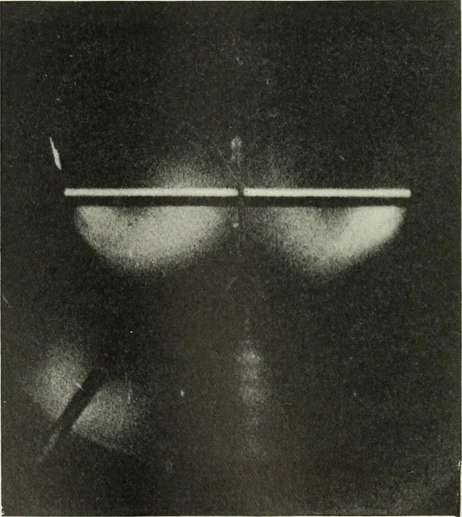 An illustration from Report, 1915, leaf 101