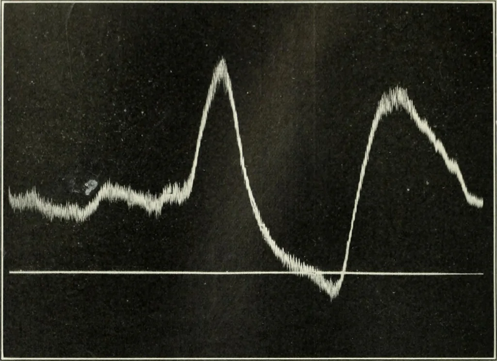 An illustration from Report, 1915, leaf 529