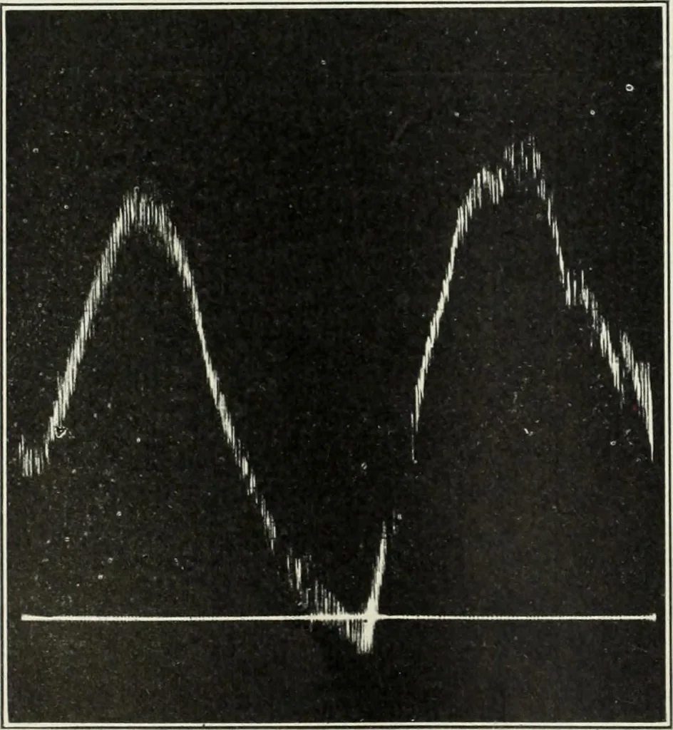 An illustration from Report, 1915, leaf 529