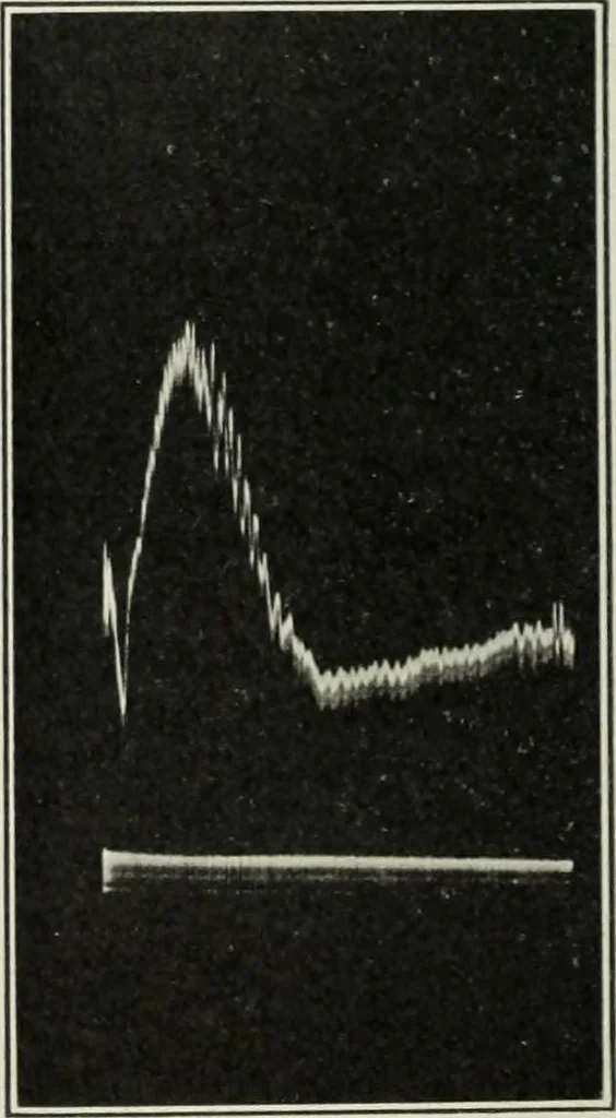 An illustration from Report, 1915, leaf 529