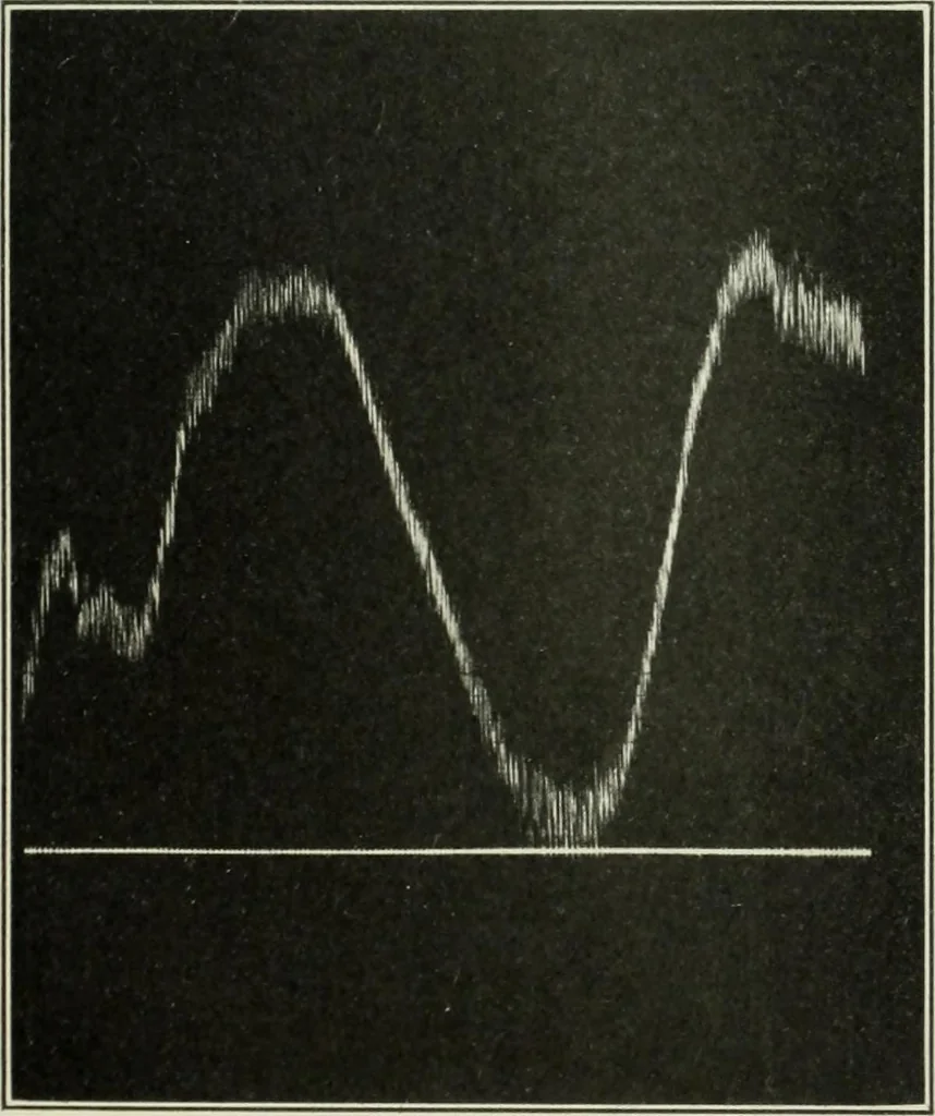 An illustration from Report, 1915, leaf 532