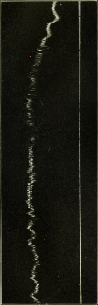 An illustration from Report, 1915, leaf 534