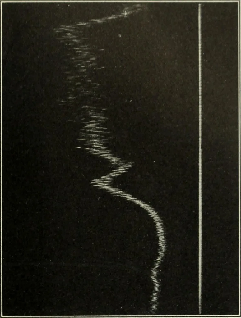 An illustration from Report, 1915, leaf 534