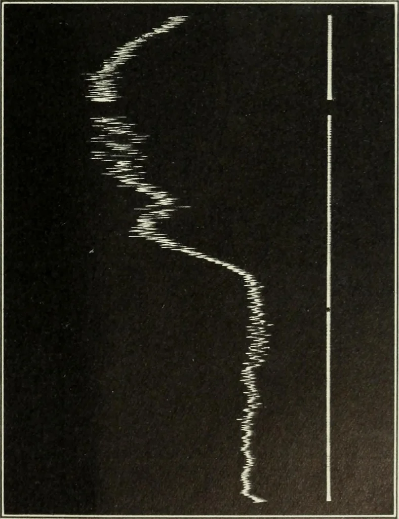 An illustration from Report, 1915, leaf 534