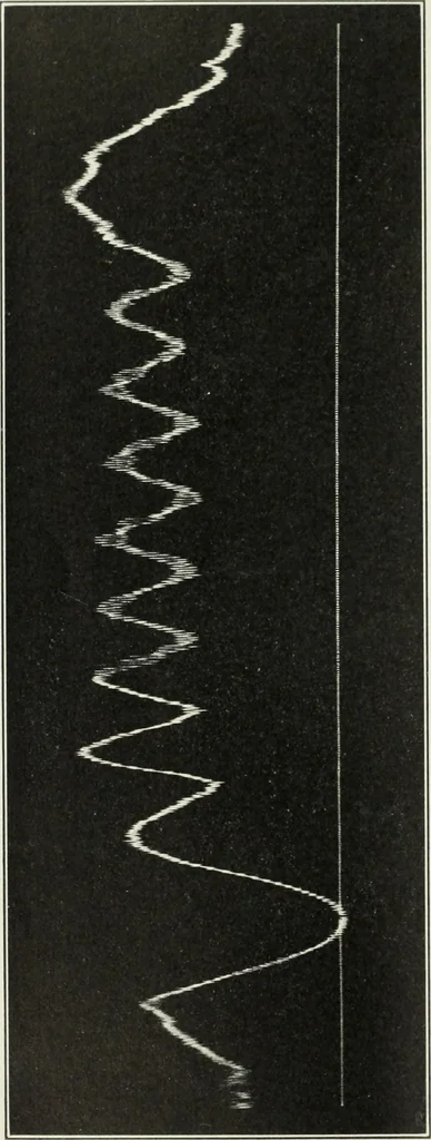 An illustration from Report, 1915, leaf 535