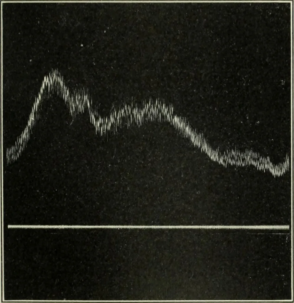 An illustration from Report, 1915, leaf 536