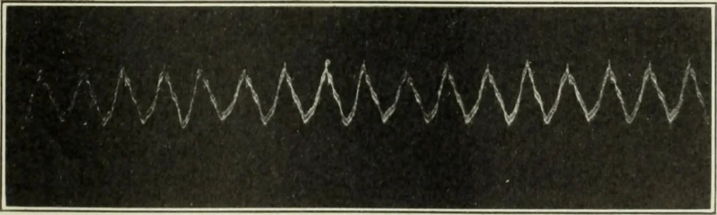 An illustration from Report, 1915, leaf 536