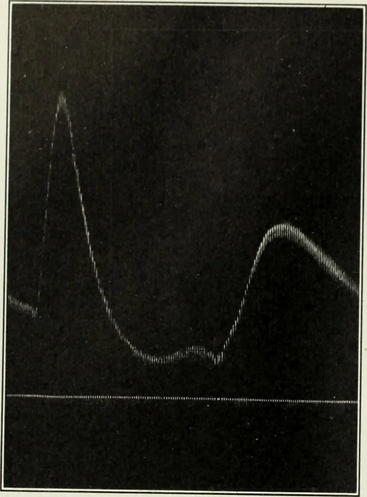 An illustration from Report, 1915, leaf 537