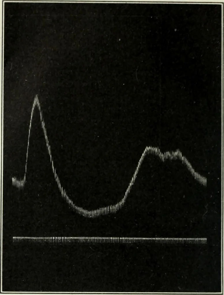 An illustration from Report, 1915, leaf 537