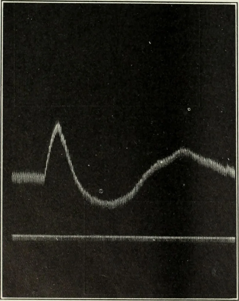 An illustration from Report, 1915, leaf 537