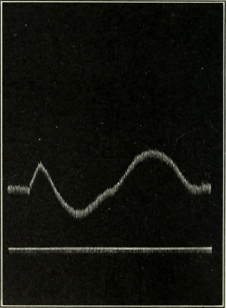 An illustration from Report, 1915, leaf 537