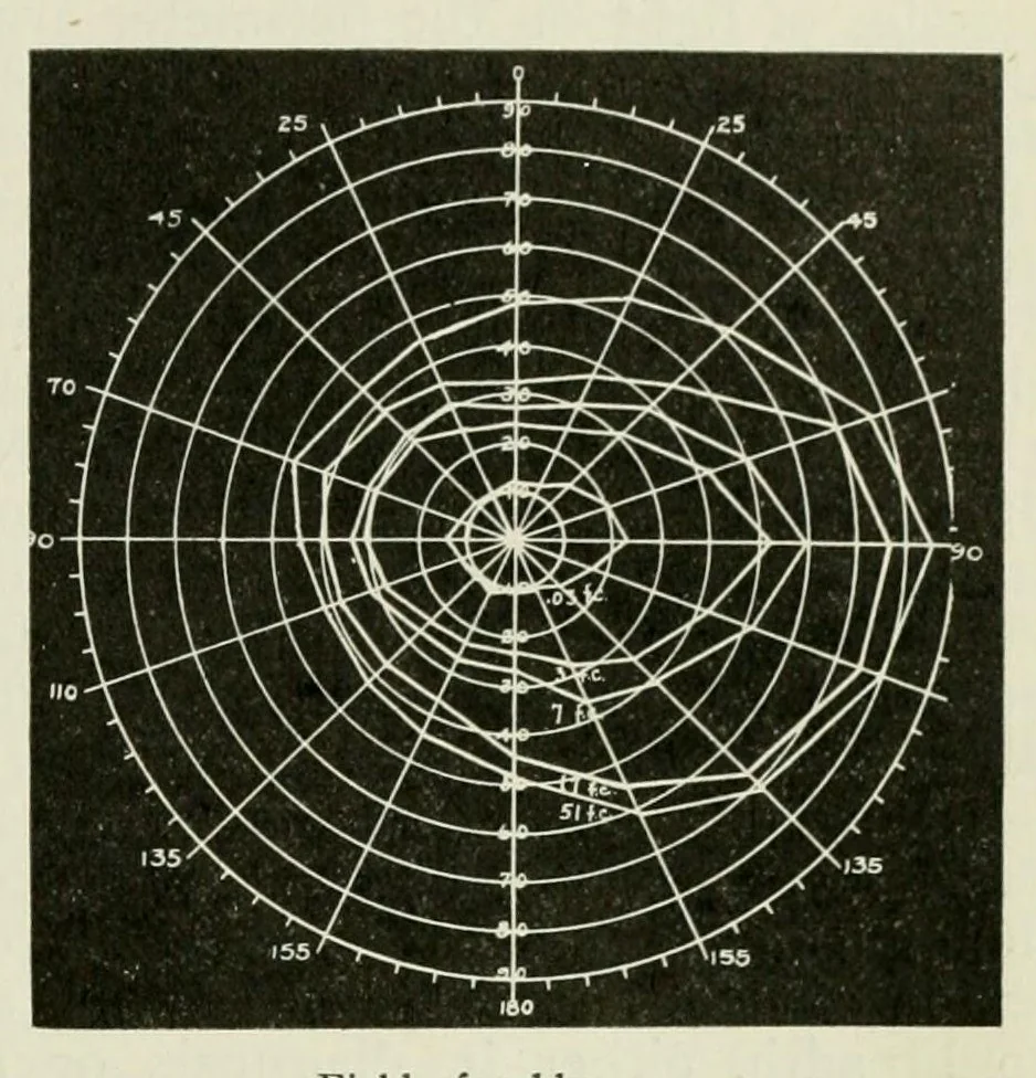 An illustration from Reprints of articles on perimetry, 1917, leaf 47