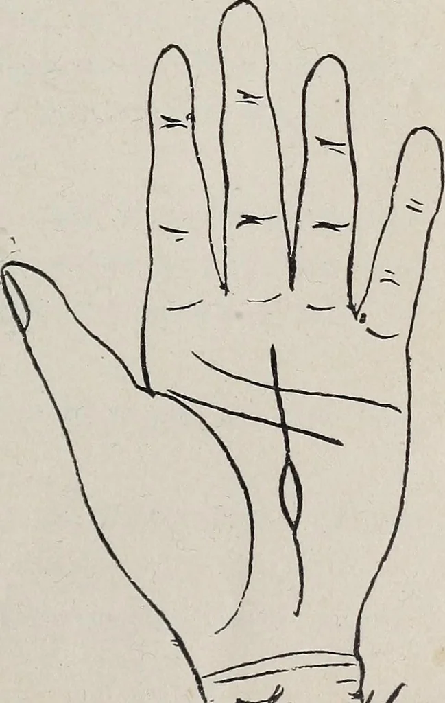 An illustration from Revelations of the hand. A scientific study of the shape and markings of the hand, as an index to character, disease, and tendencies, with explanatory illustrations, 1900, leaf 108