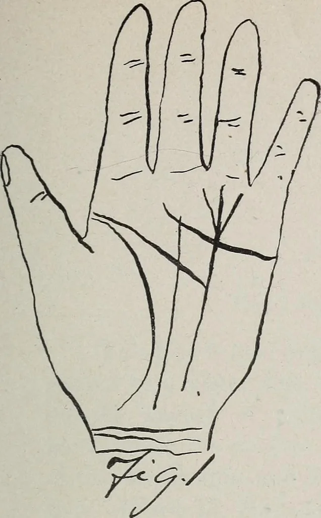 An illustration from Revelations of the hand. A scientific study of the shape and markings of the hand, as an index to character, disease, and tendencies, with explanatory illustrations, 1900, leaf 114