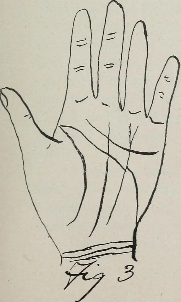 An illustration from Revelations of the hand. A scientific study of the shape and markings of the hand, as an index to character, disease, and tendencies, with explanatory illustrations, 1900, leaf 114