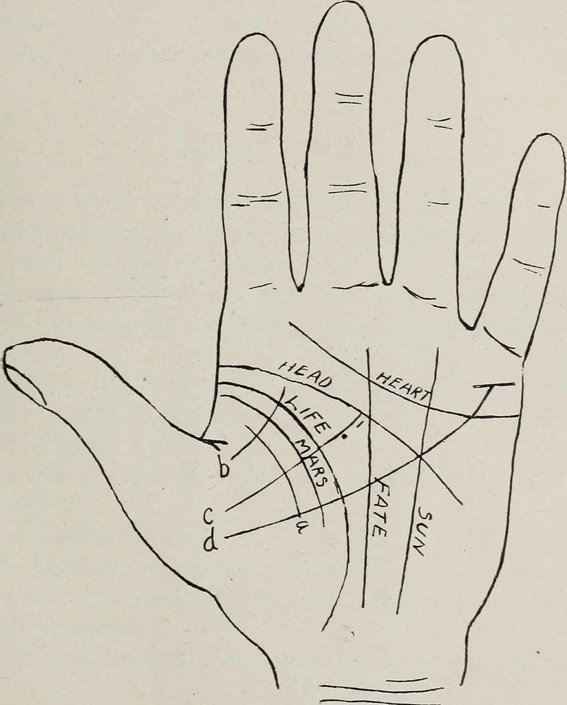 An illustration from Revelations of the hand. A scientific study of the shape and markings of the hand, as an index to character, disease, and tendencies, with explanatory illustrations, 1900, leaf 130