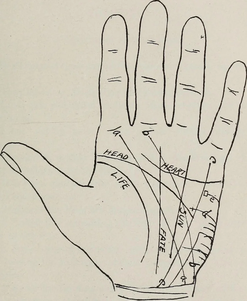 An illustration from Revelations of the hand. A scientific study of the shape and markings of the hand, as an index to character, disease, and tendencies, with explanatory illustrations, 1900, leaf 134