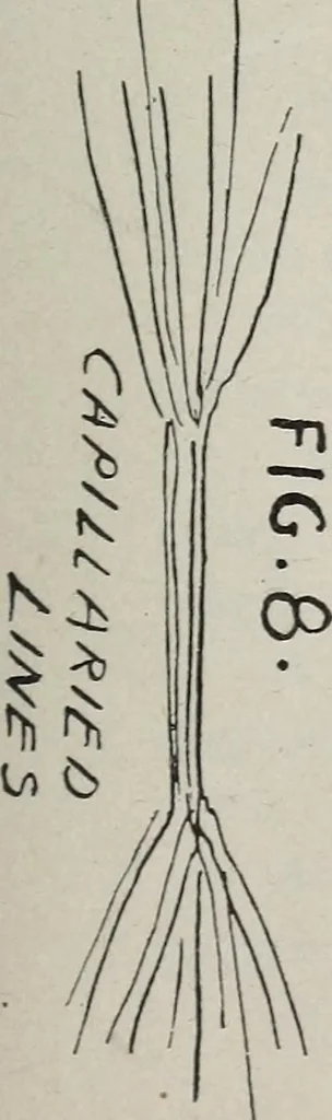 An illustration from Revelations of the hand. A scientific study of the shape and markings of the hand, as an index to character, disease, and tendencies, with explanatory illustrations, 1900, leaf 138