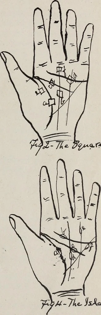 An illustration from Revelations of the hand. A scientific study of the shape and markings of the hand, as an index to character, disease, and tendencies, with explanatory illustrations, 1900, leaf 146