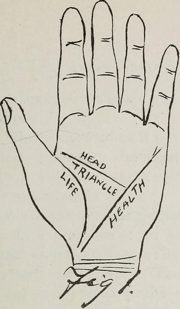 An illustration from Revelations of the hand. A scientific study of the shape and markings of the hand, as an index to character, disease, and tendencies, with explanatory illustrations, 1900, leaf 154