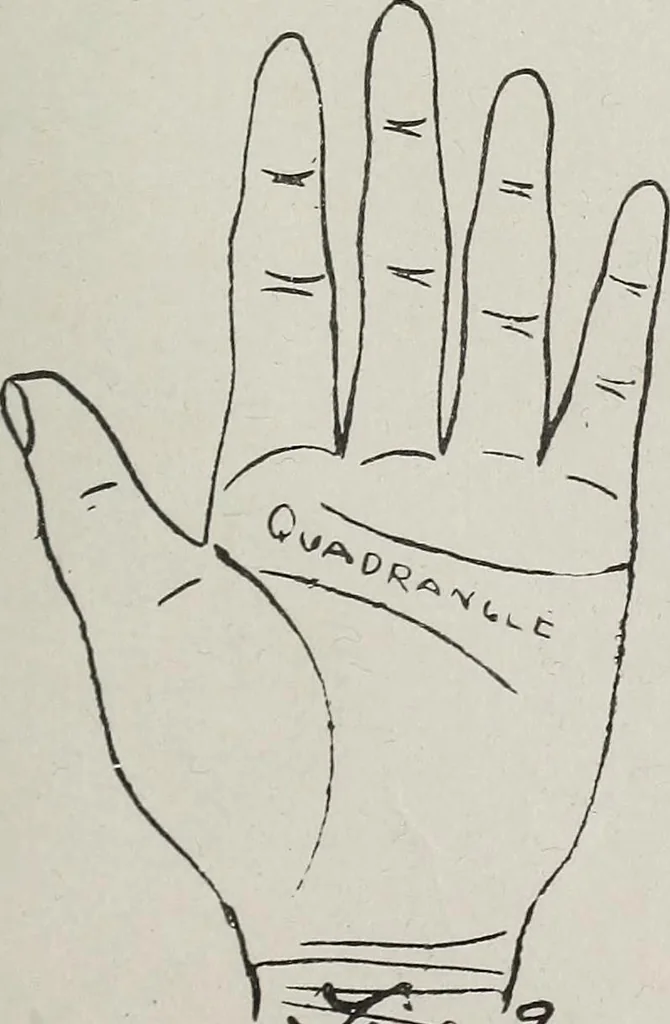 An illustration from Revelations of the hand. A scientific study of the shape and markings of the hand, as an index to character, disease, and tendencies, with explanatory illustrations, 1900, leaf 154