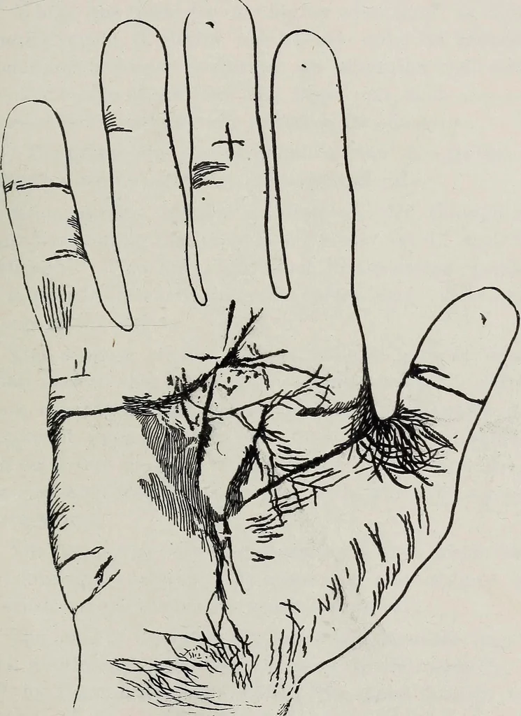 An illustration from Revelations of the hand. A scientific study of the shape and markings of the hand, as an index to character, disease, and tendencies, with explanatory illustrations, 1900, leaf 164