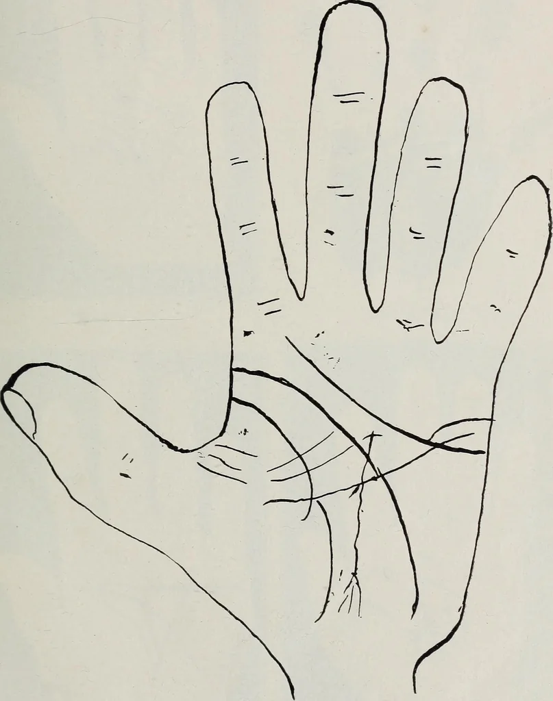 An illustration from Revelations of the hand. A scientific study of the shape and markings of the hand, as an index to character, disease, and tendencies, with explanatory illustrations, 1900, leaf 168