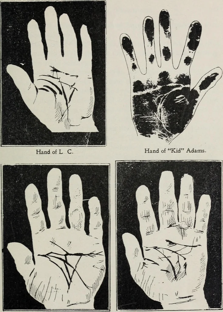 An illustration from Revelations of the hand. A scientific study of the shape and markings of the hand, as an index to character, disease, and tendencies, with explanatory illustrations, 1900, leaf 170
