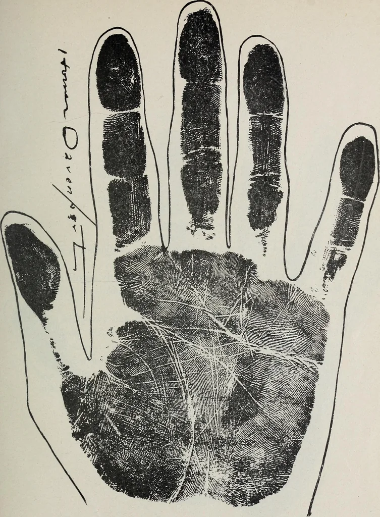 An illustration from Revelations of the hand. A scientific study of the shape and markings of the hand, as an index to character, disease, and tendencies, with explanatory illustrations, 1900, leaf 184