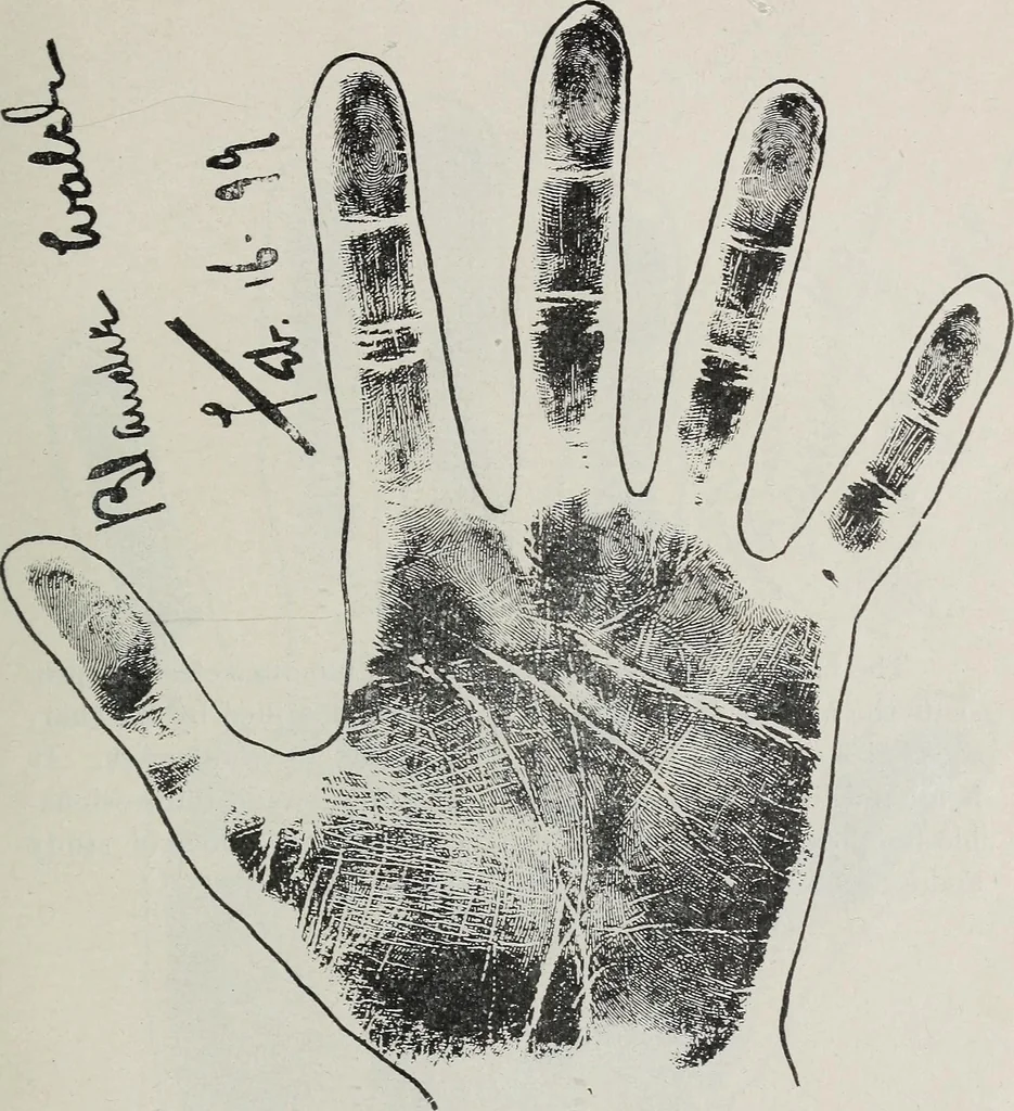 An illustration from Revelations of the hand. A scientific study of the shape and markings of the hand, as an index to character, disease, and tendencies, with explanatory illustrations, 1900, leaf 188