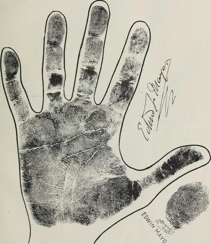 An illustration from Revelations of the hand. A scientific study of the shape and markings of the hand, as an index to character, disease, and tendencies, with explanatory illustrations, 1900, leaf 200
